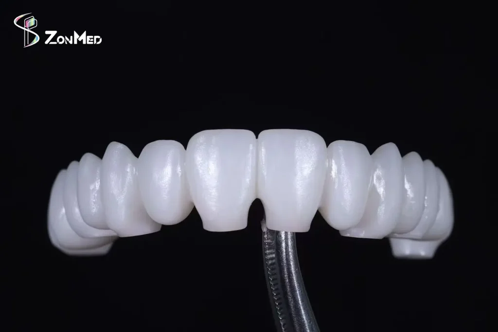 Zonmed Undyed White Zirconia Dental Bridge - High Translucency Monolithic Zirconia Restoration for Dental Labs