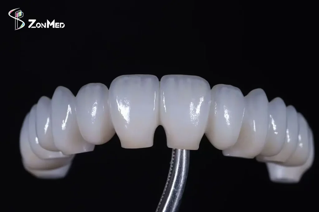 Zonmed Low-Temperature Sintered Dental Ceramic Bridge - Post-Firing Aesthetic Result for Dental Labs