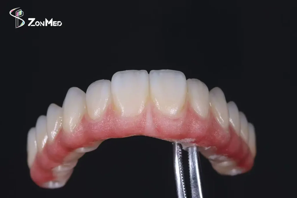 Zonmed Low-Temperature Sintered Ceramic Restoration - Full-Arch Zirconia Bridge with Gingiva for Dental Labs