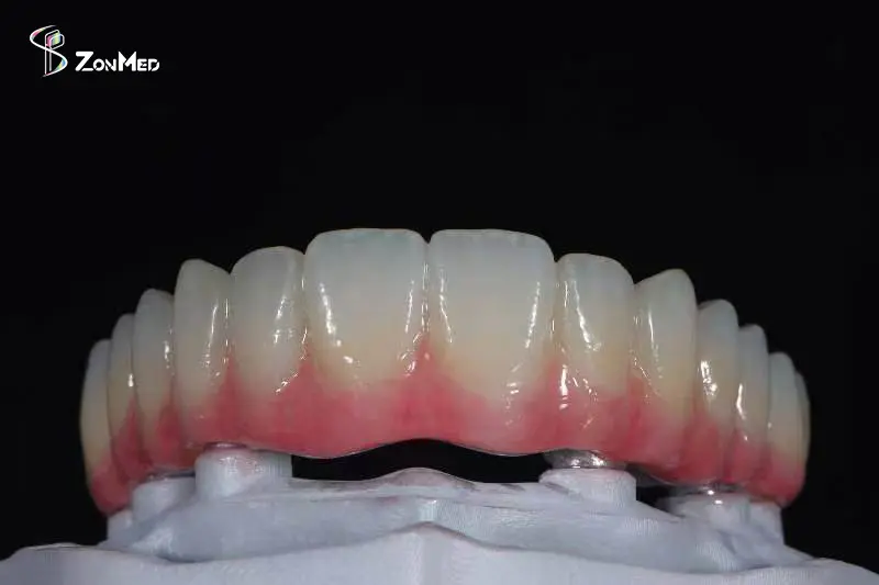 Zonmed finished stained dental restoration after characterization and coloring