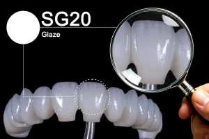 Zonmed SG20 Glaze application on full arch dental restoration with magnified zoom detail