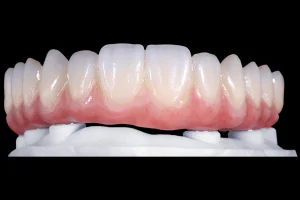Zonmed ceramic dental staining kit aesthetic staining effect comparison showing natural crown and gingival color integration