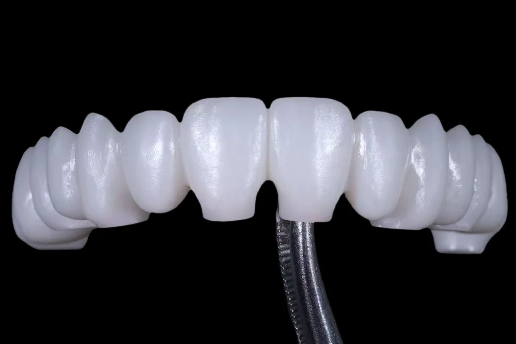 Zonmed G20 full arch dental restoration in unglazed state showing crown structure